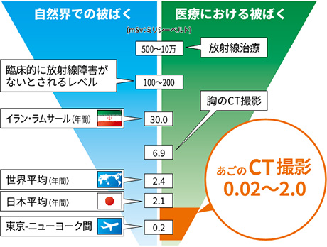 CT撮影による被ばくについて